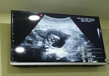 สอบถามแม่ๆหน่อยค่ะ