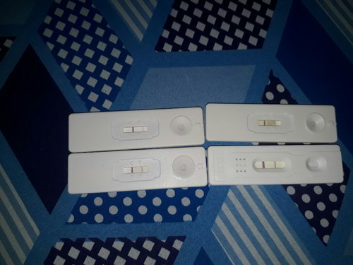 normal ba?