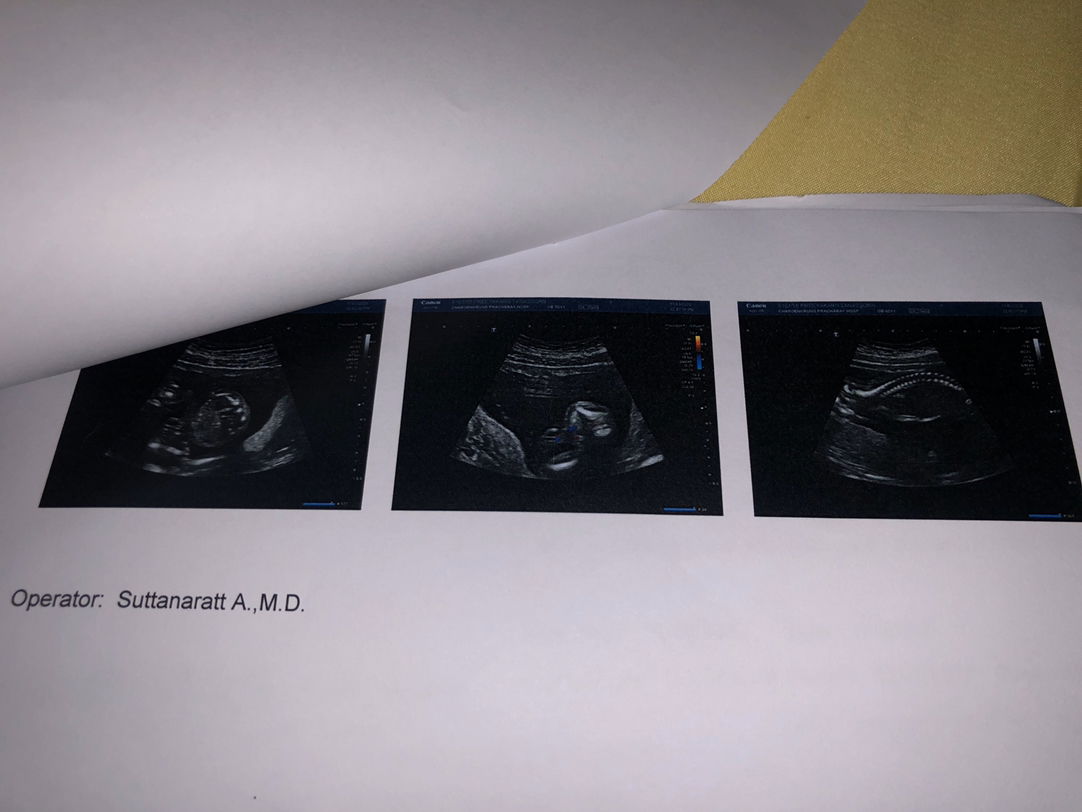 แม่ๆกี่วีคกันแล้วคะ