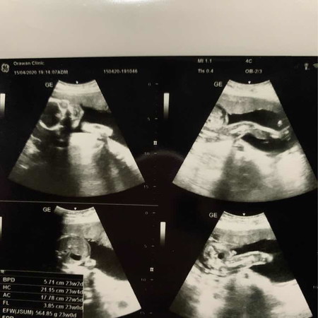 เดากันเล่นๆค่ะ ชายหรือหญิงค่ะ