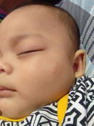 baby skin care.