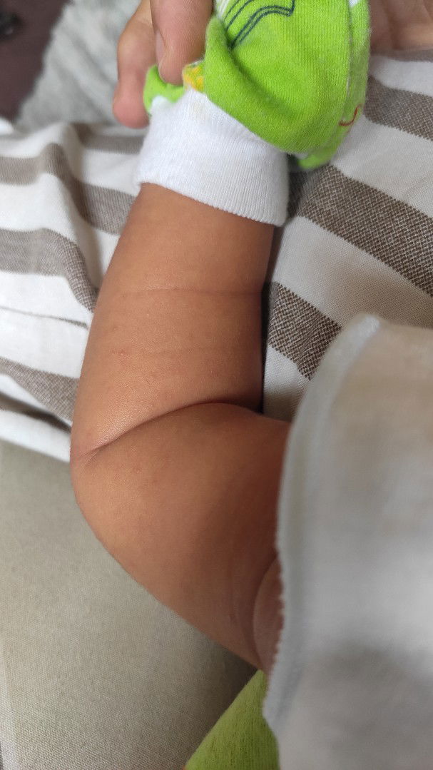 kulit bayiku sensitif?