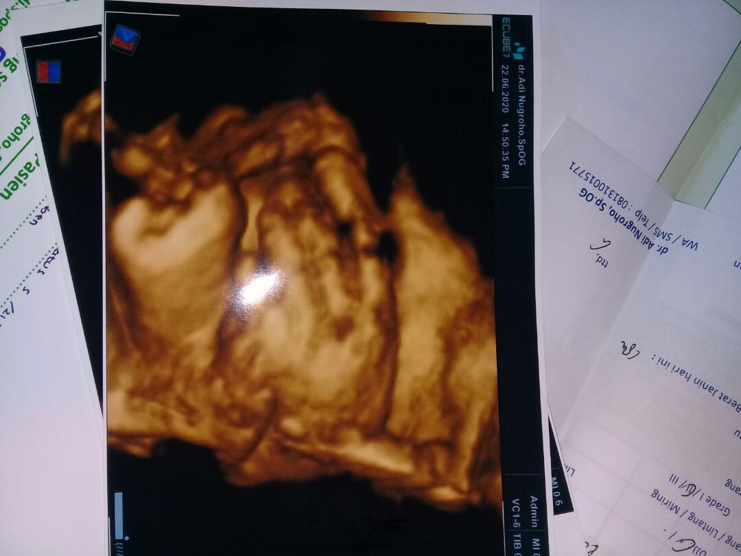 Aminatus Syukrillah profile icon