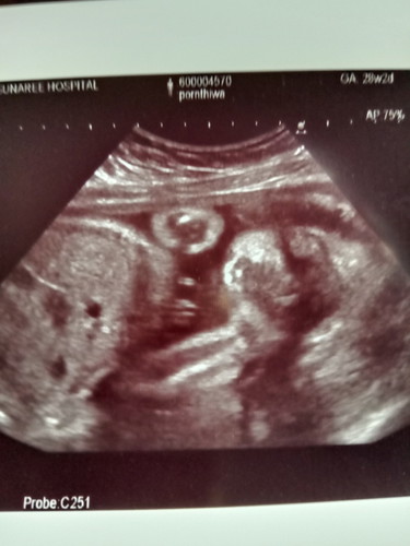 28+2w