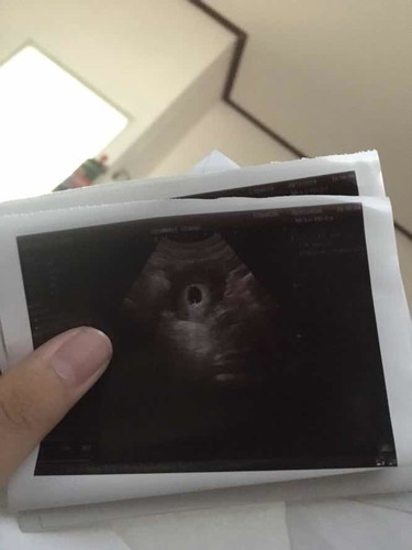 สอบถามแม่ๆค่ะ