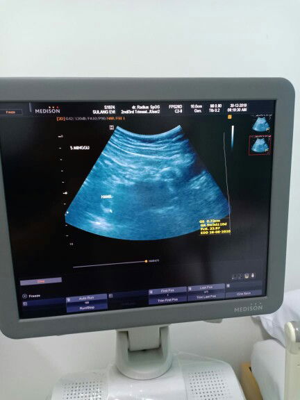 sulang evi profile icon