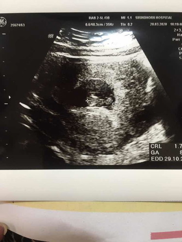 อายุครรภ์