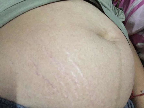 สอบถามแม่ๆ