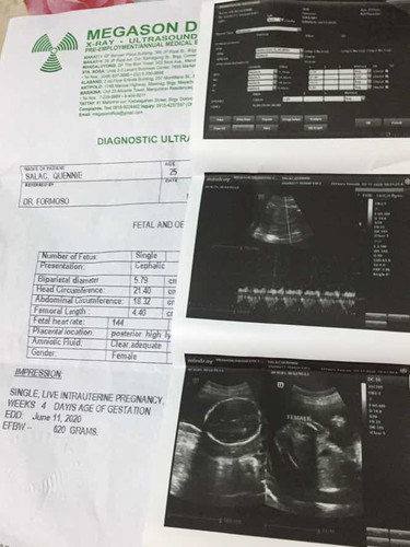 Ultrasound