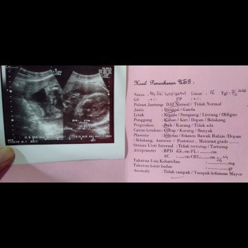 hamil 26 w