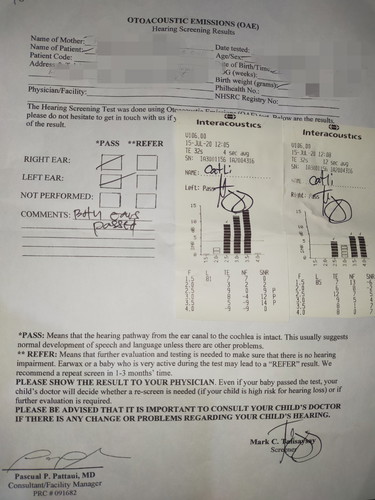 magugulatin ba si baby?!