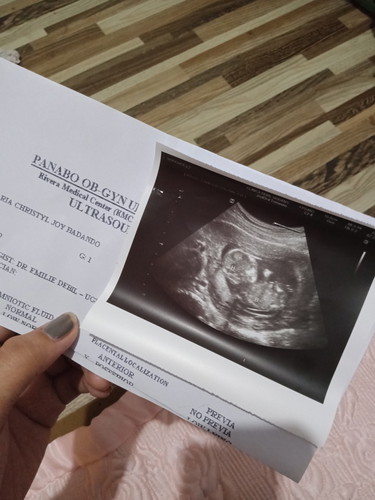 preggy moments