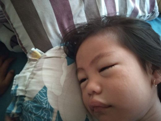 muka bengkak setelah minum susu dingin