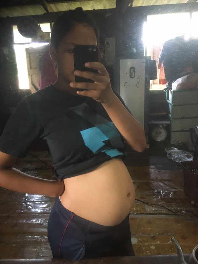 กำหนดคลอด