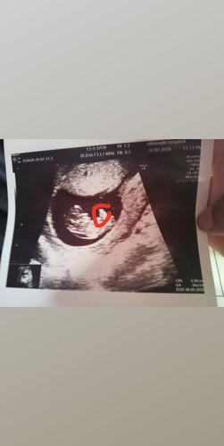 ที่วงไว้คือส่วนไหนของน้องคะแม่ๆ?