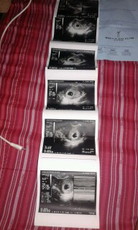 13 weeks and 0 day now!!