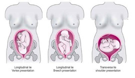 Breech Problem