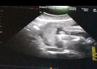 sape pandai tgk scan ni?