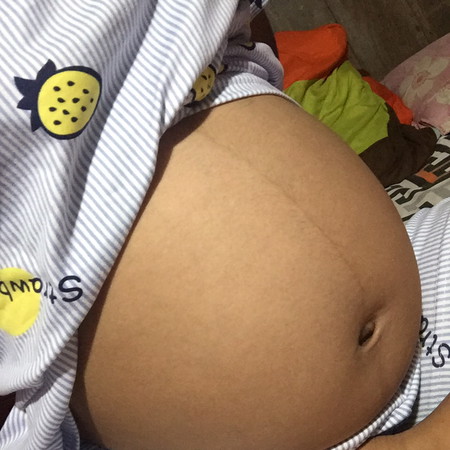 ท้องเล็ก