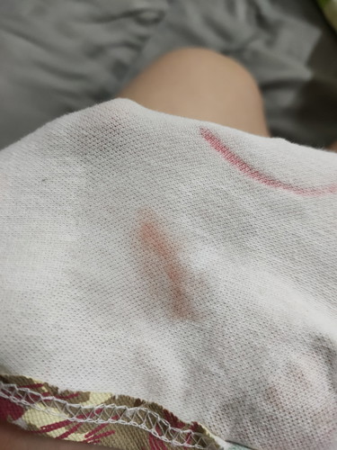 ท้อง 6สัปดาห์ แล้วมีเลือด