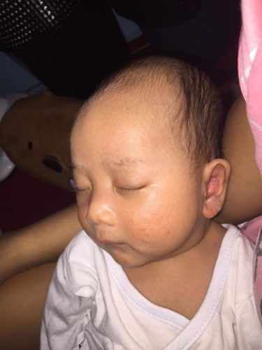 Mga mommies look ano po kaya yung nasa leeg at pisngi ng baby ko??