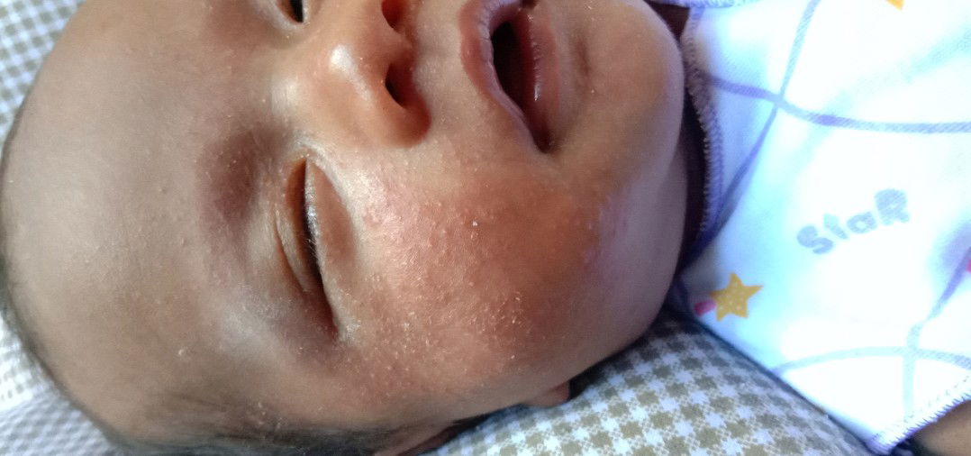 wajah bayi merah