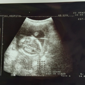 อ่านใบอัลซาว