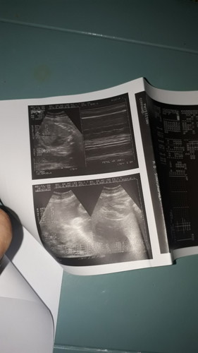 ultrasound result