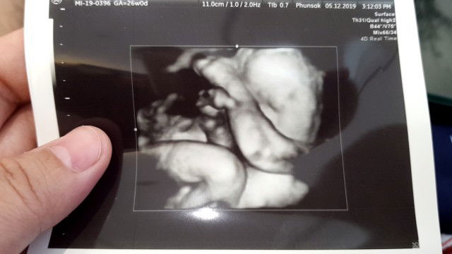 Phaew Phirunphak profile icon