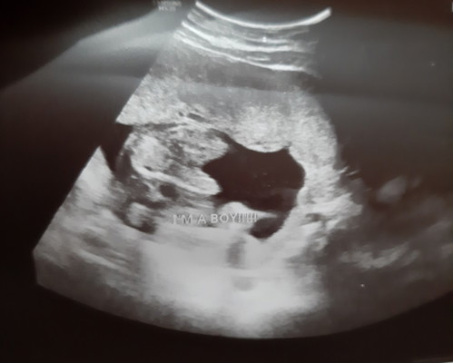 Baby's gender