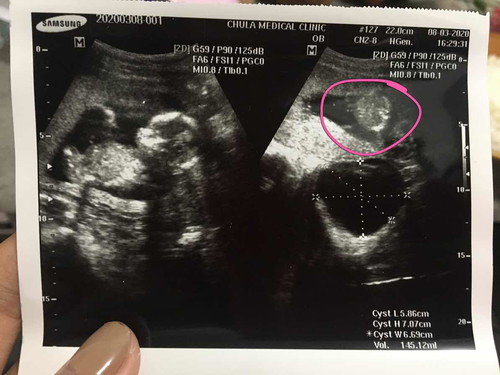 ญ หรือ ช ค่ะ