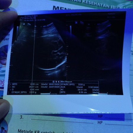 bingung liat tgl tafsiran