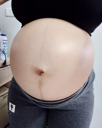 38+1