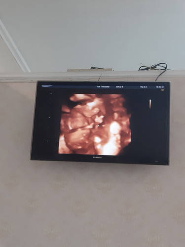 18w 6 d ผู้ชาย100% จ้า