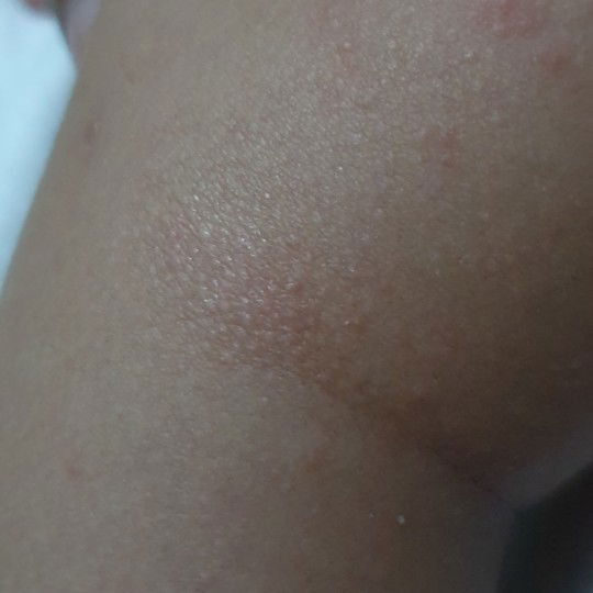 baby skin concern