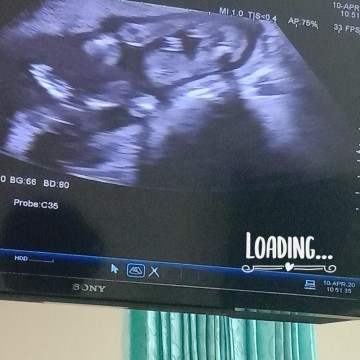 แม่ๆรู้เพศลูกกันตอนไหนคะ