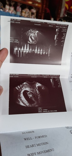 10w2d