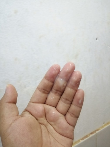 Sign Of Labor?