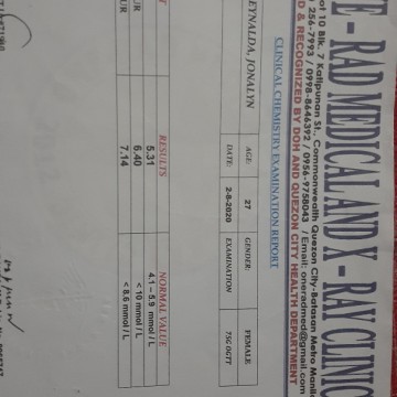 OGT