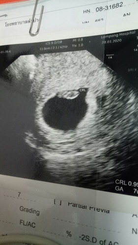 ตั้งครรภ์7วีค