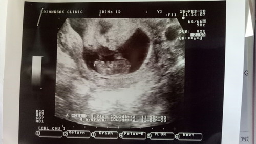 เลือดออก