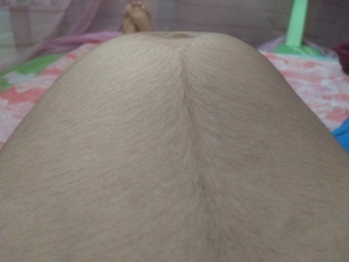 เเบบนี้น้องโก่งตัวใช่ไมค่ะ