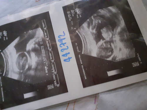 ลูกรัก