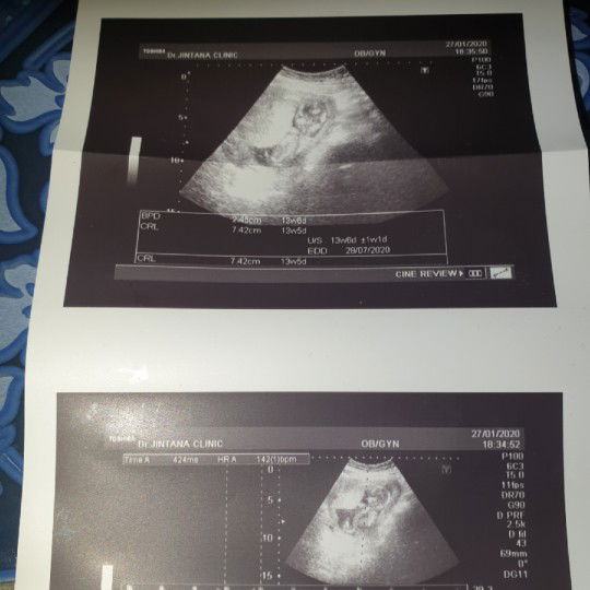 นอนเล่นมือสบายใจเลยยยยย?