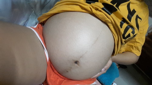 34 +4 week เจ็บจี๊ดที่หัวเหน่า