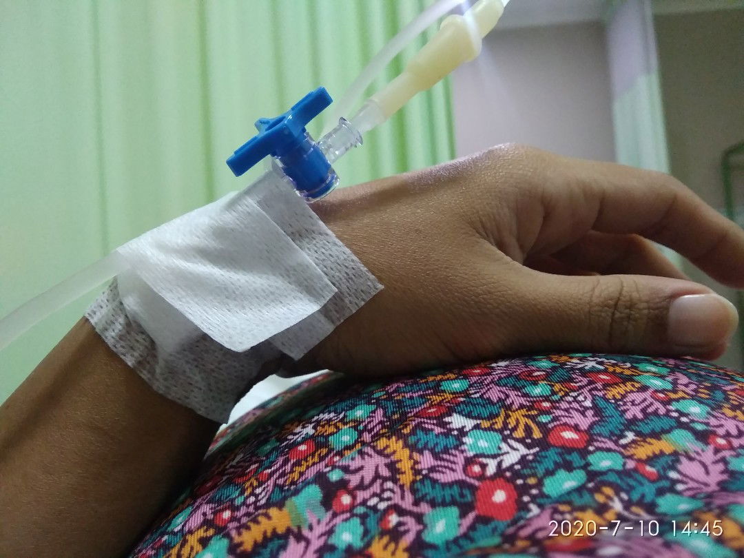 ketuban pecah usia 34 w