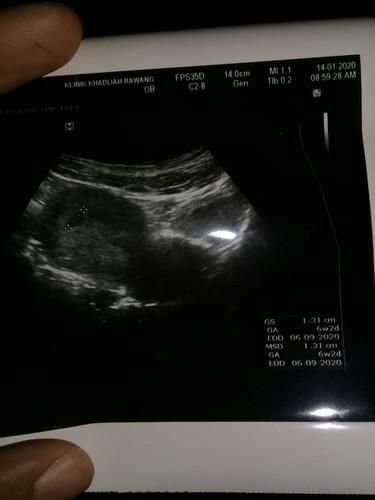 kalau ikut period tracker bby da 7 week