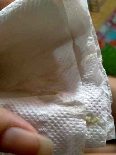 ท้องแรก