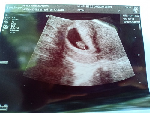 Alhamdulillah... First Baby