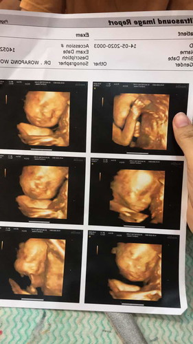 แชร์ภาพอัลตราซาวด์ 4มิติค่ะ